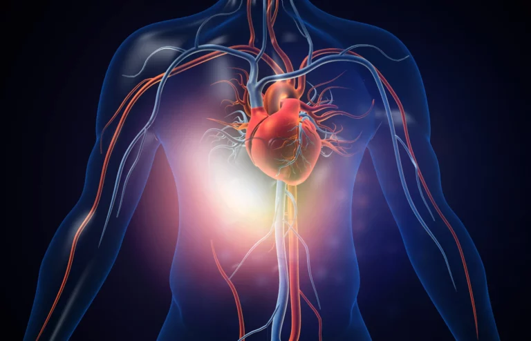 cardiomyopathie dilatée hypokinétique