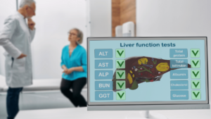 Carcinome hepatocellulaire
