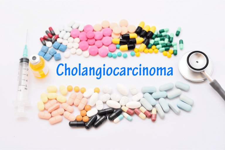 Cholangiocarcinome