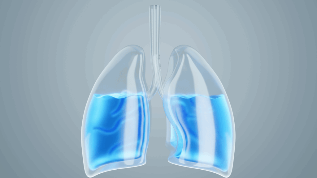 Eau dans les poumons : quelle espérance de vie ? Tout sur cette urgence médicale à ne jamais ignorer Eau dans les poumons espérance de vie
