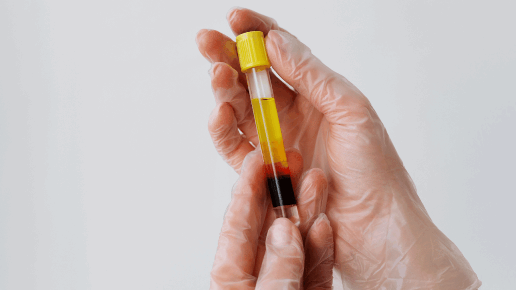 Taux de bilirubine et cancer