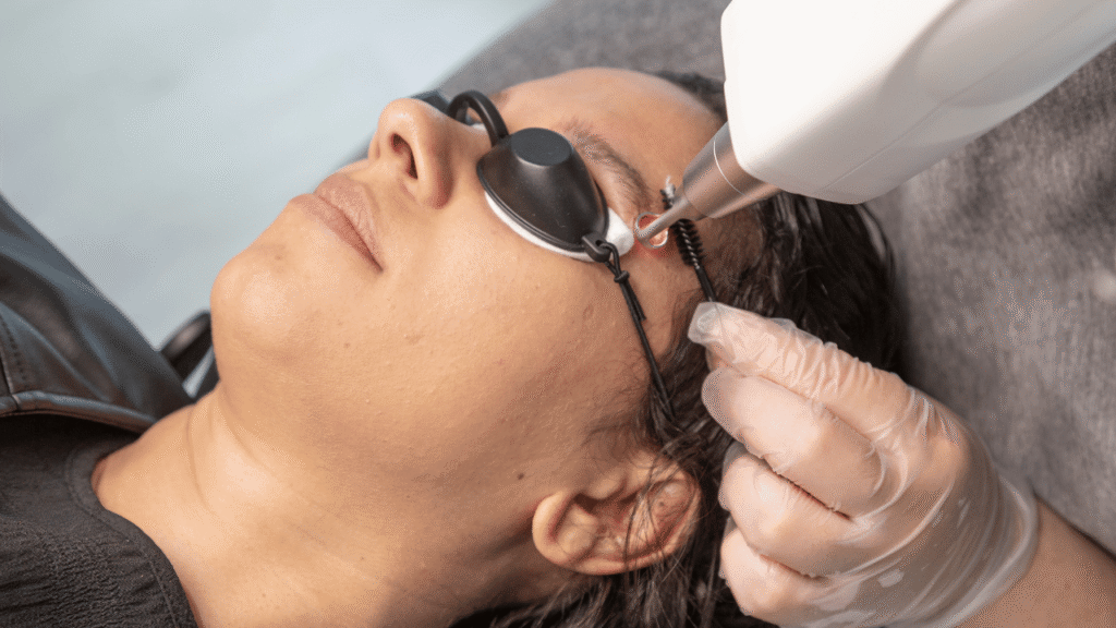 Détatouage sourcil Ray Studios